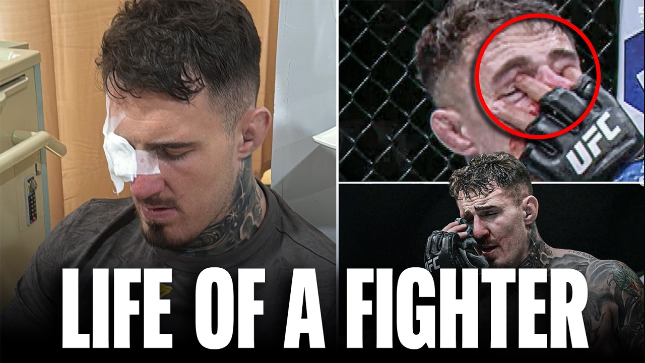 The Truth Behind Tom Aspinall’s UFC 321 Eye Poke